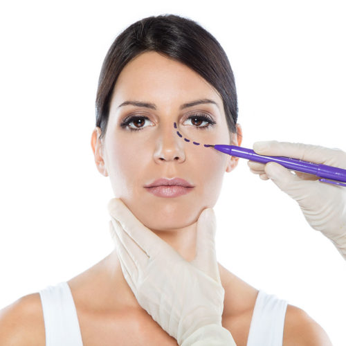 Cirugía de Párpados Cirugía de Párpados