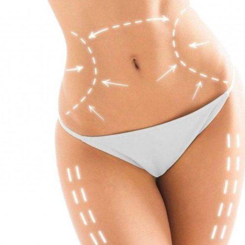 Lipoescultura Láser Lipoescultura Láser