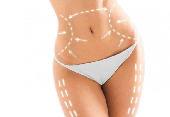 Lipoescultura Láser