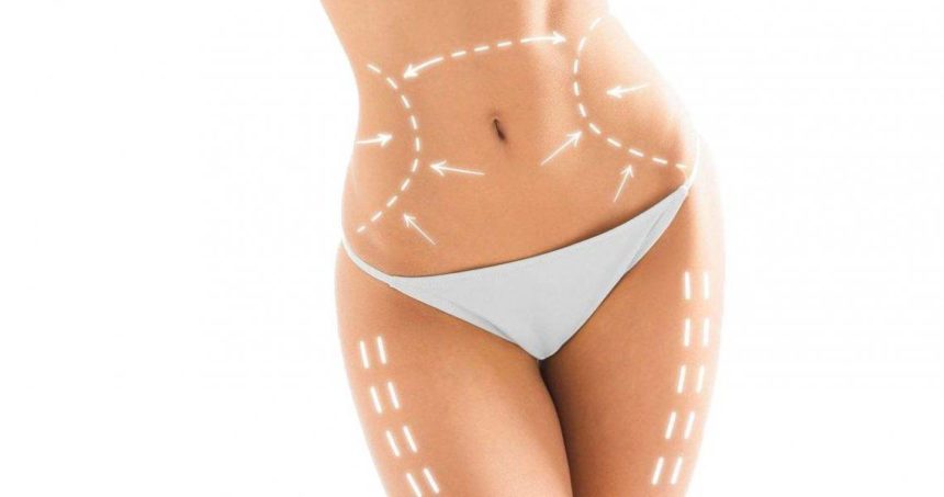 Lipoescultura Láser Lipoescultura Láser