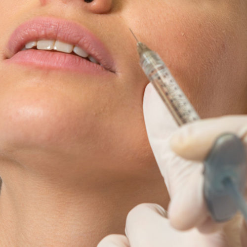 Relleno con Radiesse®