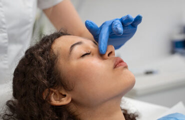 rinoplastia