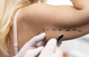 close-up-hand-drawing-patient
