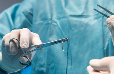 surgical-procedure-made-by-doctor(1)